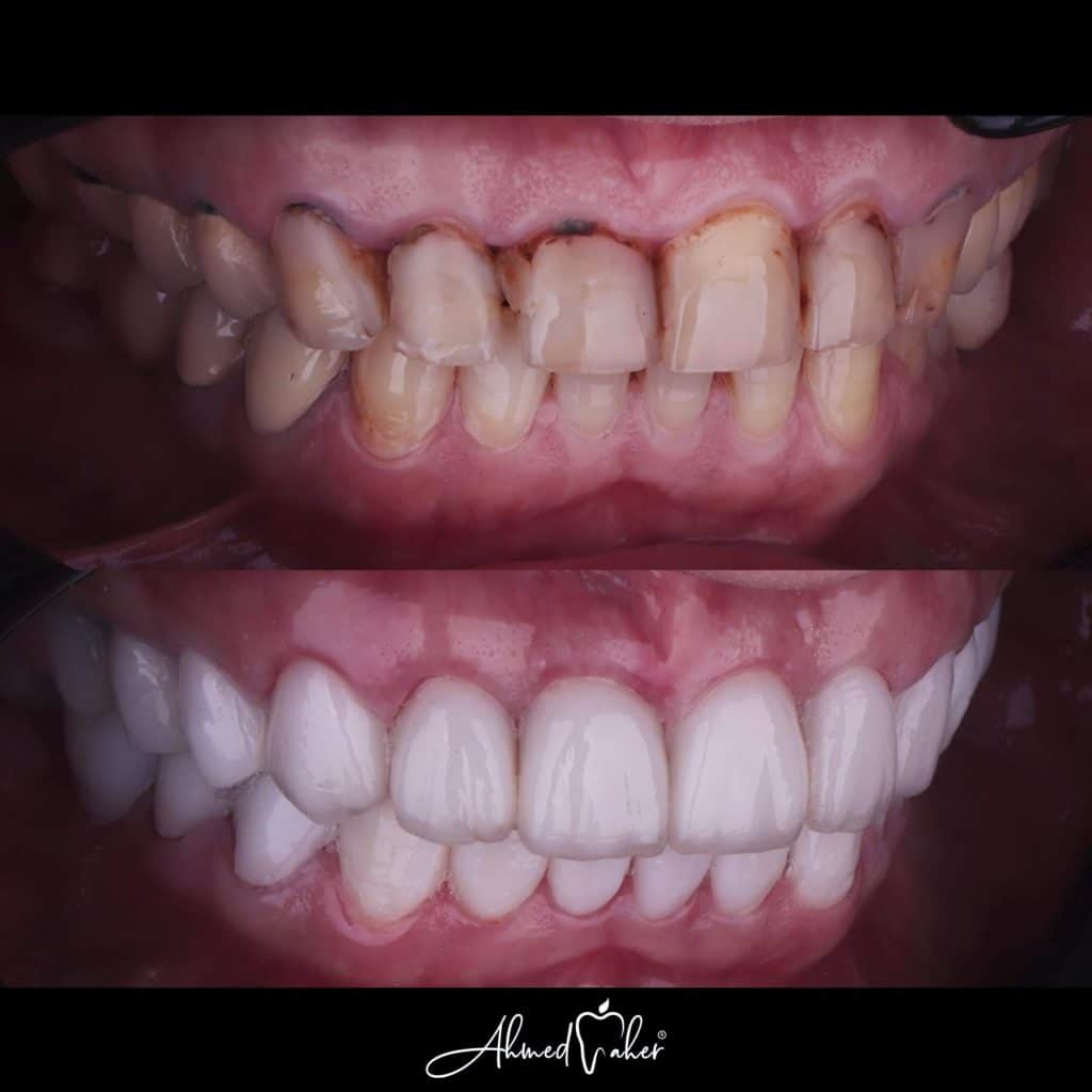 CF255E3B-5FD7-4AEF-8B74-DF5CDE2D7AE0