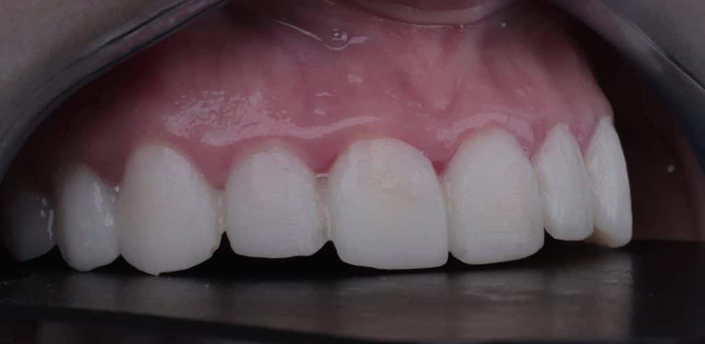 D82D175C-FD73-47FD-8848-F7A08DEA0F66