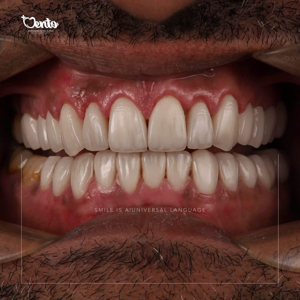 DB637EAD-14D2-4BB6-857F-CBD24CC37BFA