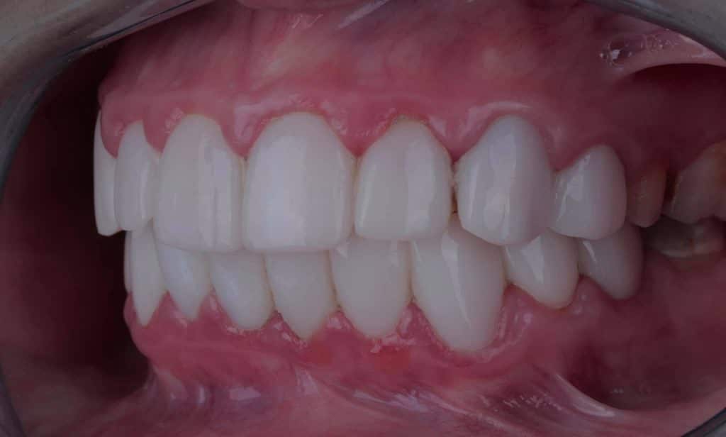 DB90DE7B-1291-4071-BA4E-90FD48935360