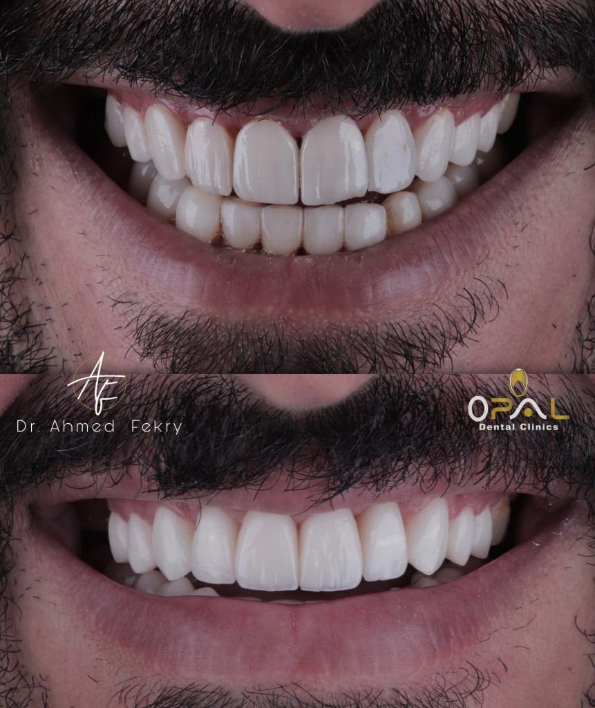 DD7DD4CB-160B-4594-A8CD-F85BF625B30C