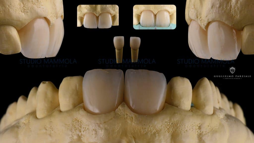 DE1803FC-A4FB-4C66-B1B9-E367919FAA11