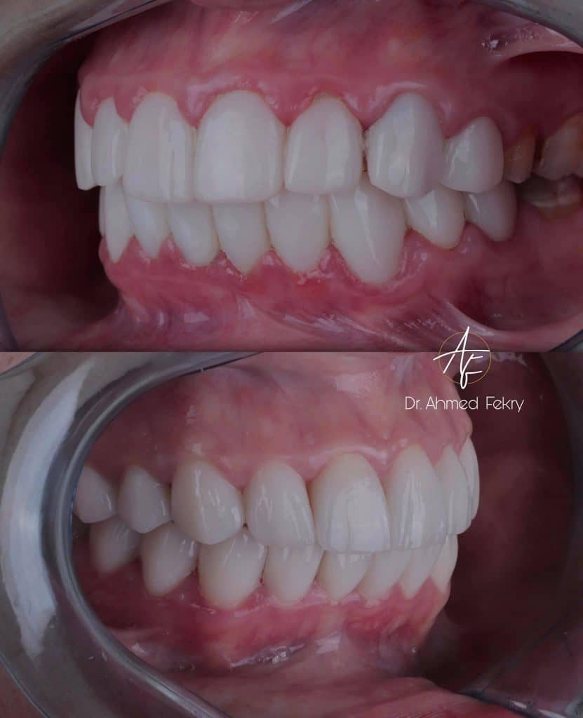 DF1C7C8C-E611-4EEC-91C6-F93CD6017264