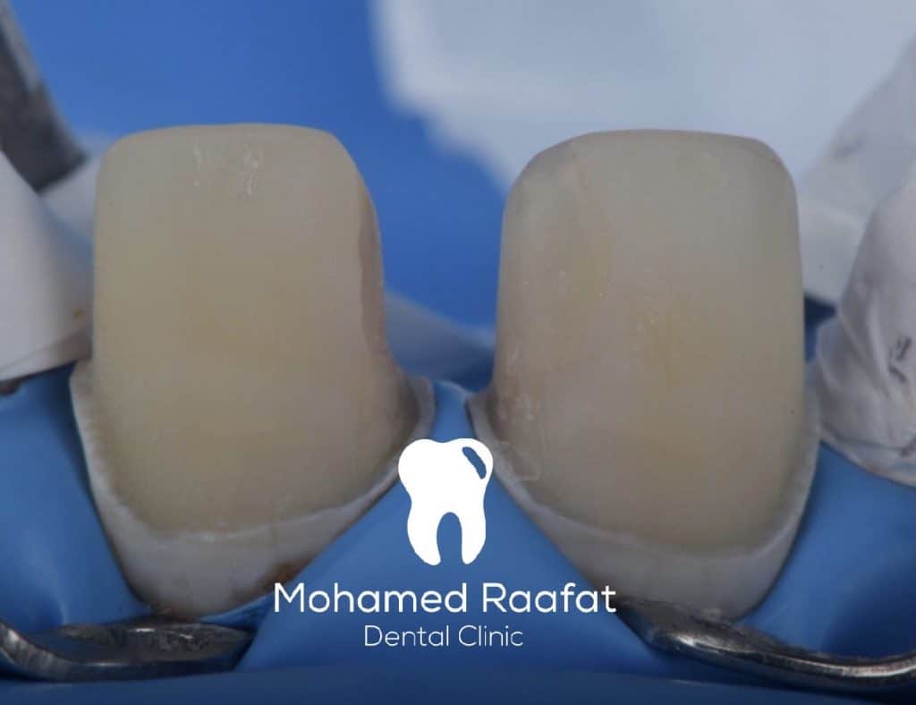 DF524064-14F5-4CD4-B0FB-2F6472717B82