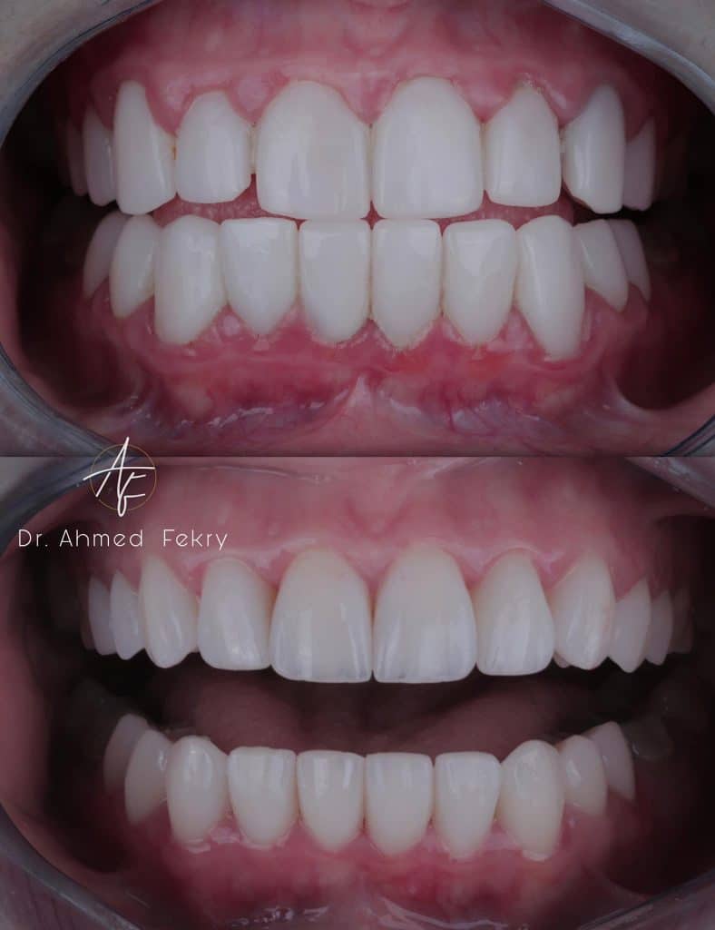 E03ACC5A-FAC5-48BD-9791-DC137296BCDA