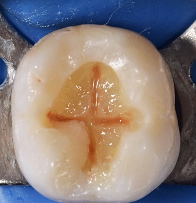 EAB0EED6-80B0-4555-8AFF-746D283E4413