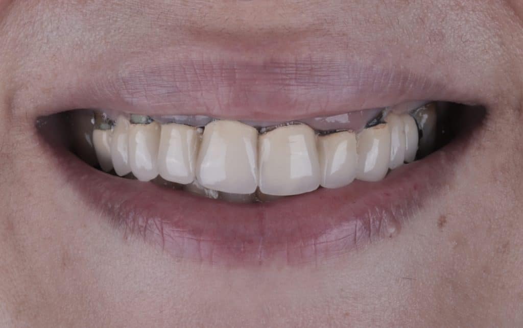 F1186C96-7AB1-44A7-8859-D4AF07B53FD1