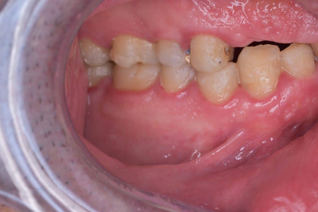 F7051523-312A-4184-A718-4BCA0A3A0722