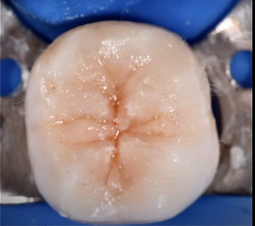 F7A5FCF6-FFC9-4235-8EA8-C1B90ABA4687