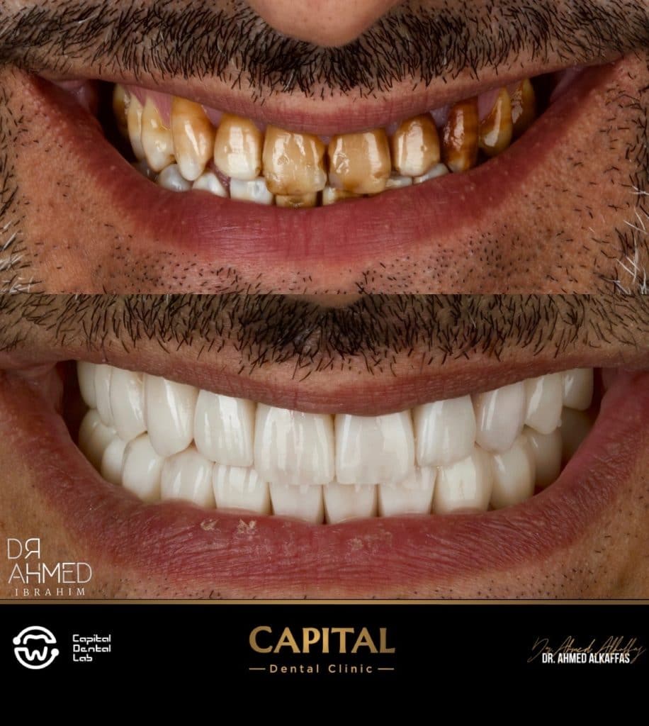 Processed with MOLDIV