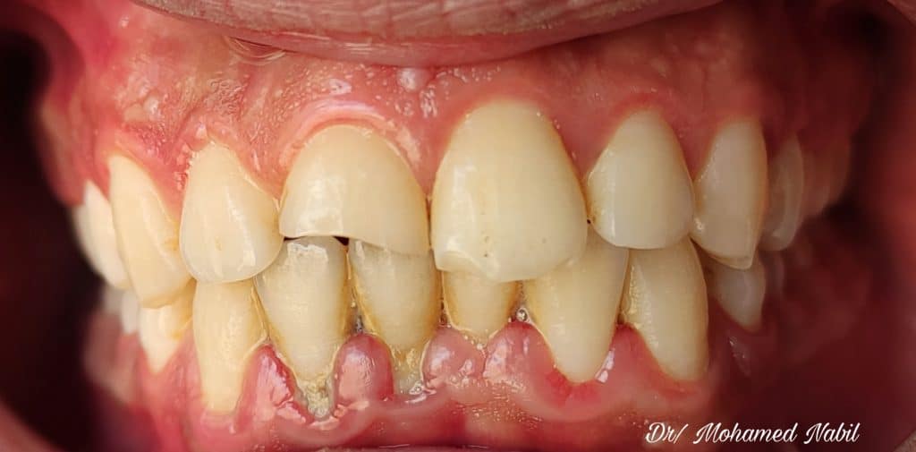 PicsArt_04-01-07.18.38