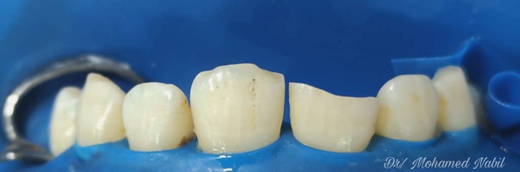 PicsArt_04-01-07.31.31