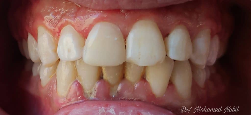 PicsArt_04-01-07.41.27