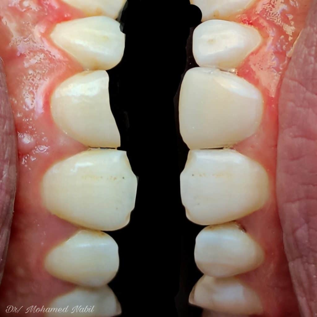 PicsArt_04-01-08.31.44