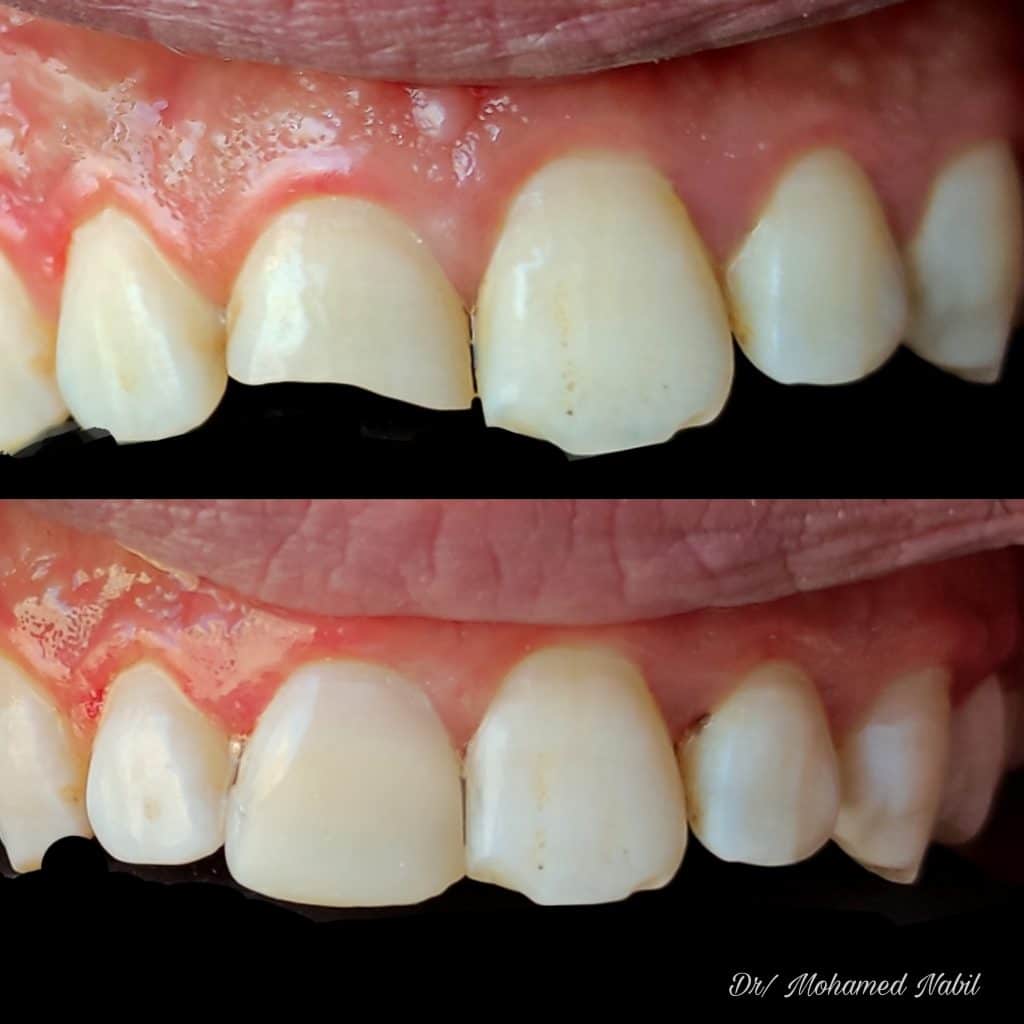 PicsArt_04-01-08.36.04