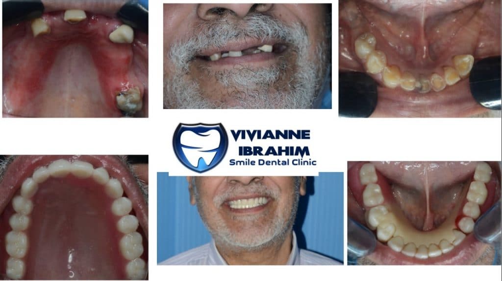 inbound1890168905223229803