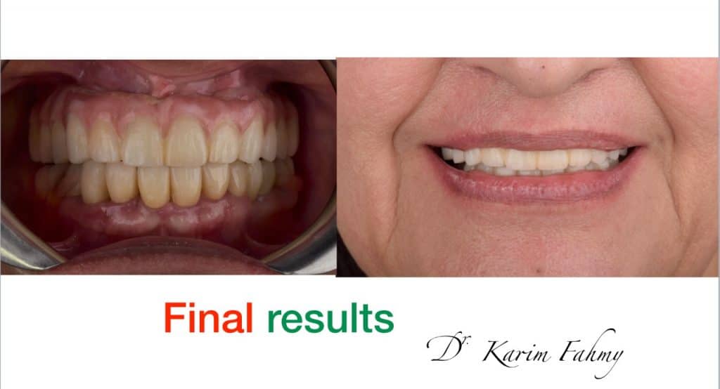 inbound5763098812108384743