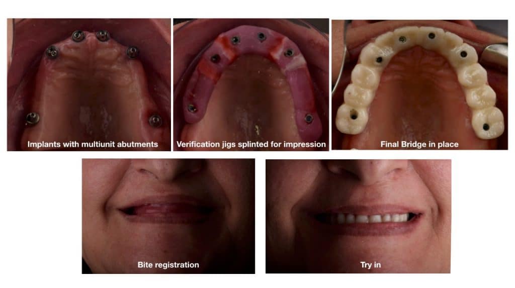 inbound6593788267857398003