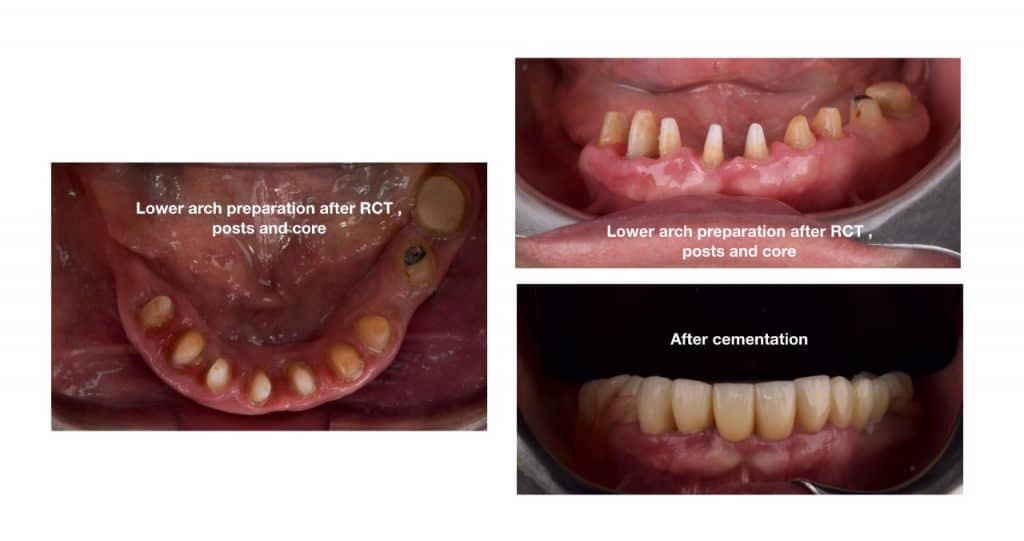 inbound6961015680853906077