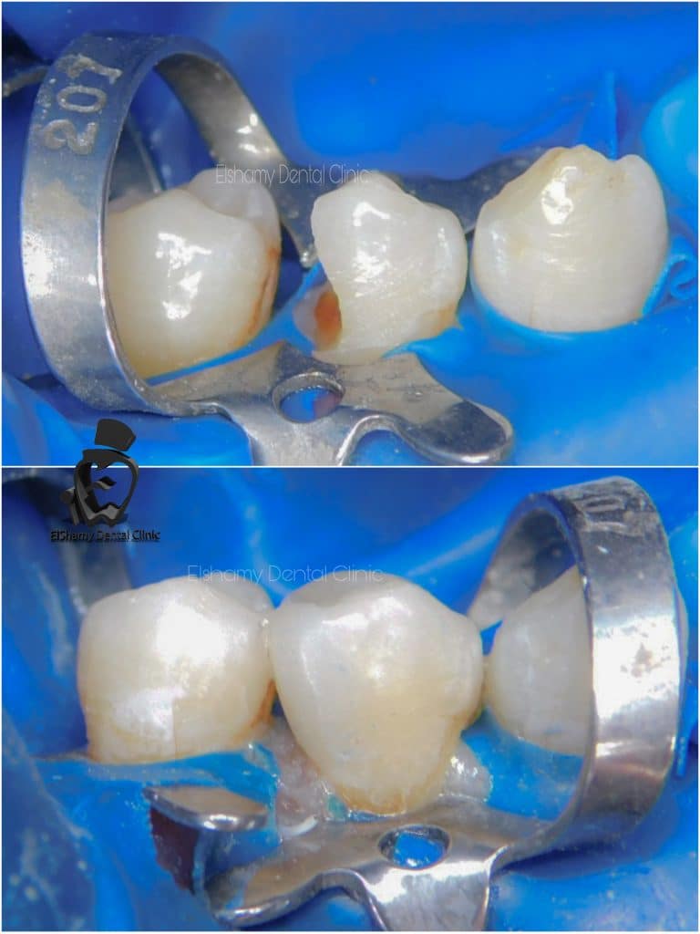 inbound8215200546365336151