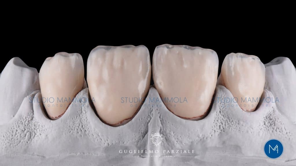 1D1D80D7-1543-4505-BB93-C9DB8128260F