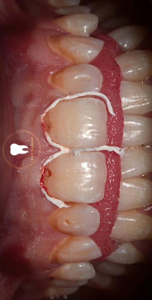 20210515144223_IMG_0052