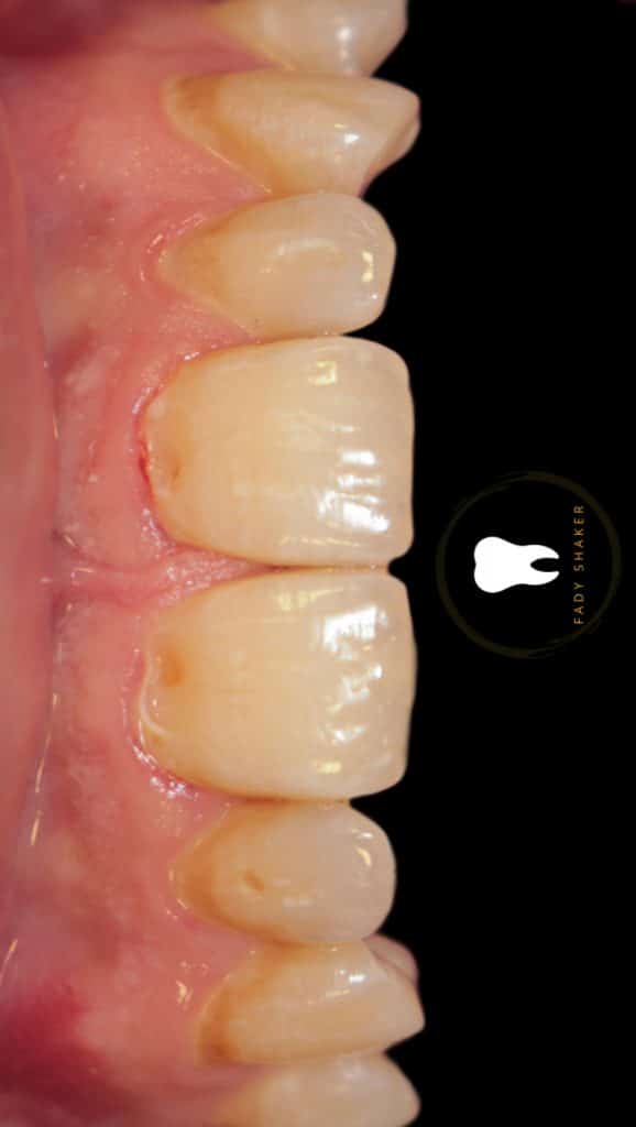 20210515144943_IMG_0054