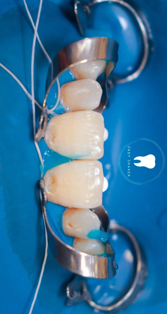 20210515151225_IMG_0058 (1)