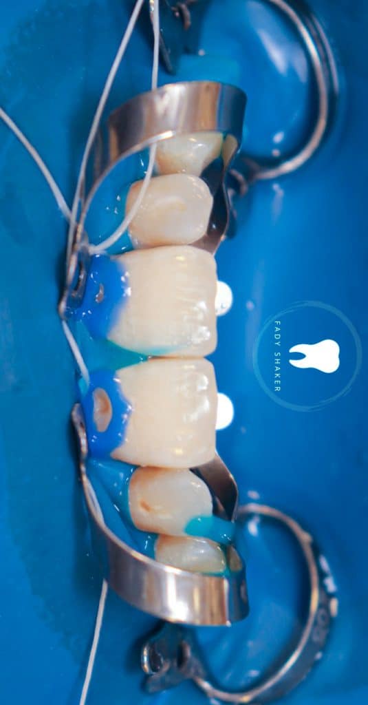 20210515151625_IMG_0060