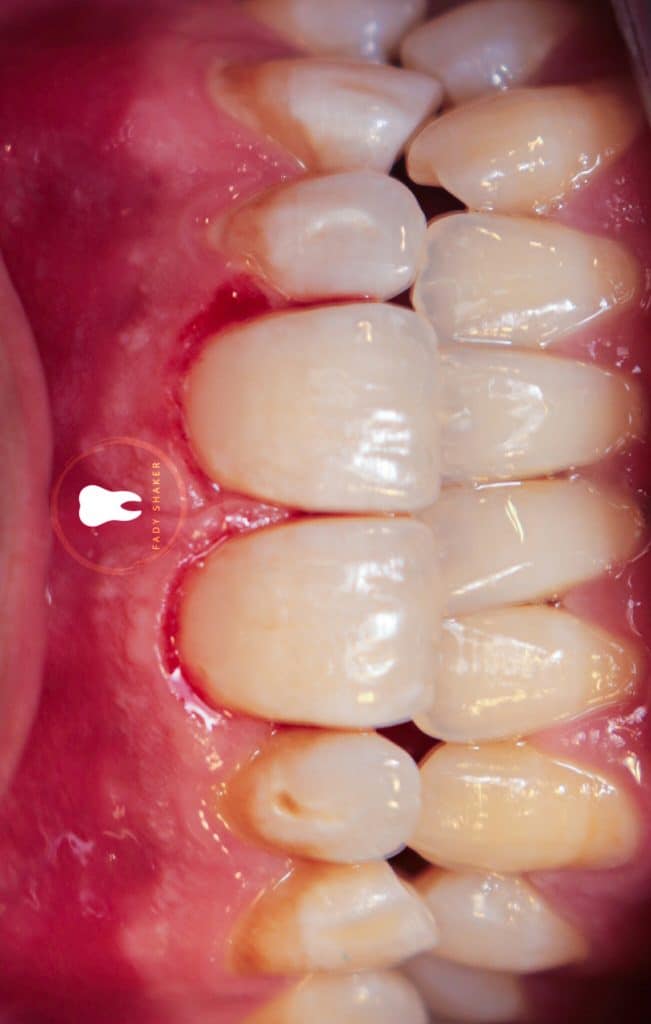 20210515162052_IMG_0067