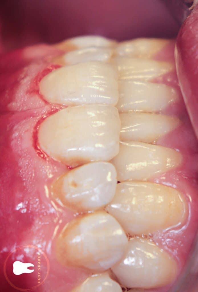 20210515162341_IMG_0072