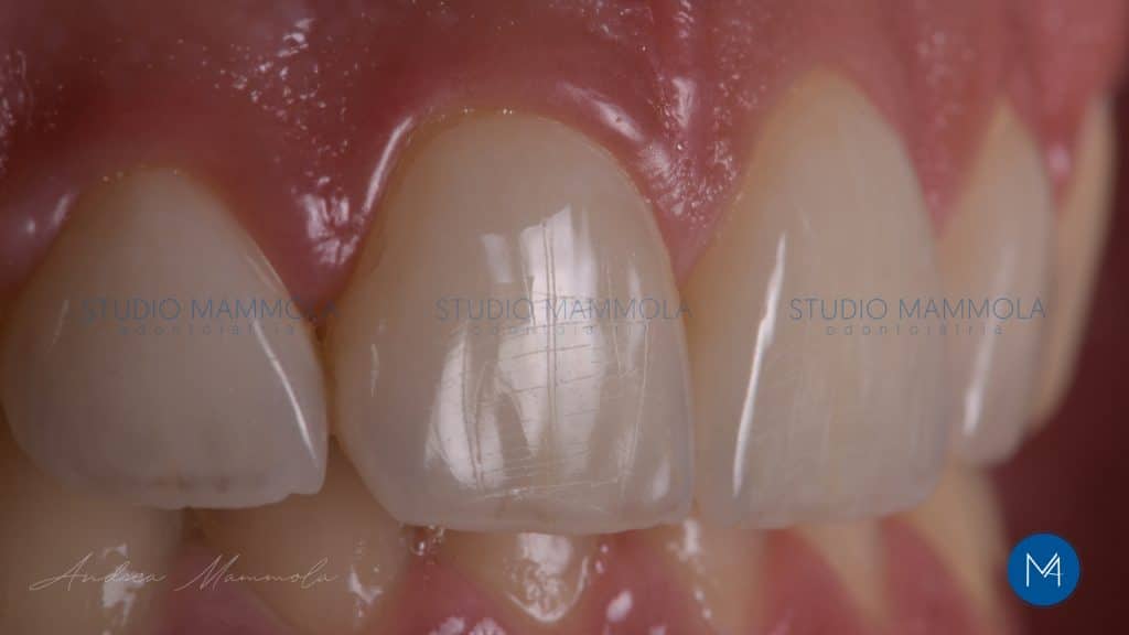 943B8038-51CC-4556-9FFB-7B7AFB2543FF