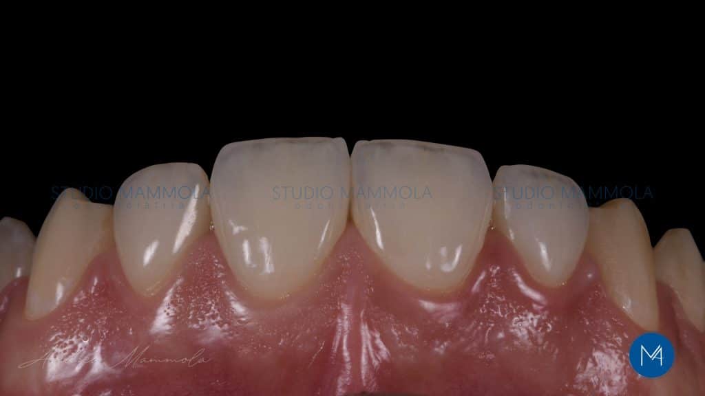 B719EB2B-D64E-4060-8A63-EA9B8CCD369F