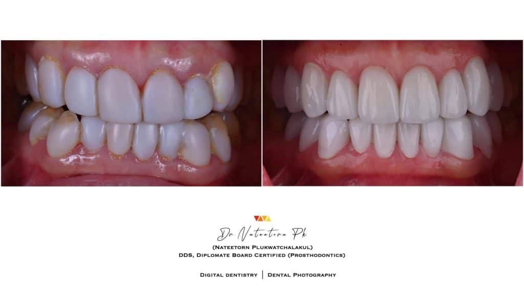 CDD016B0-E04D-40AA-B185-A14D8B261AC7