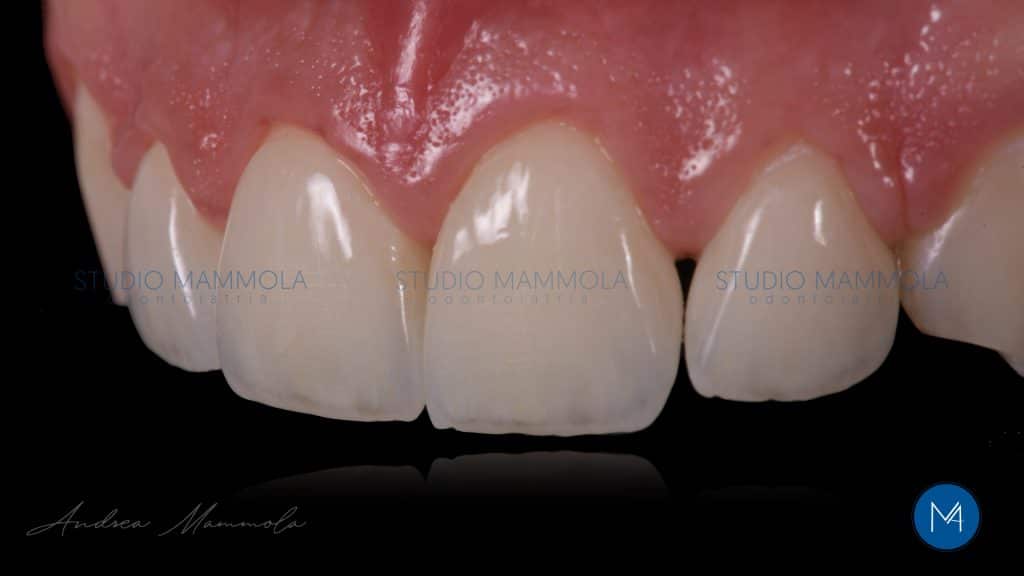 E1F5AA4E-008E-4636-9A44-F5CA421061E2