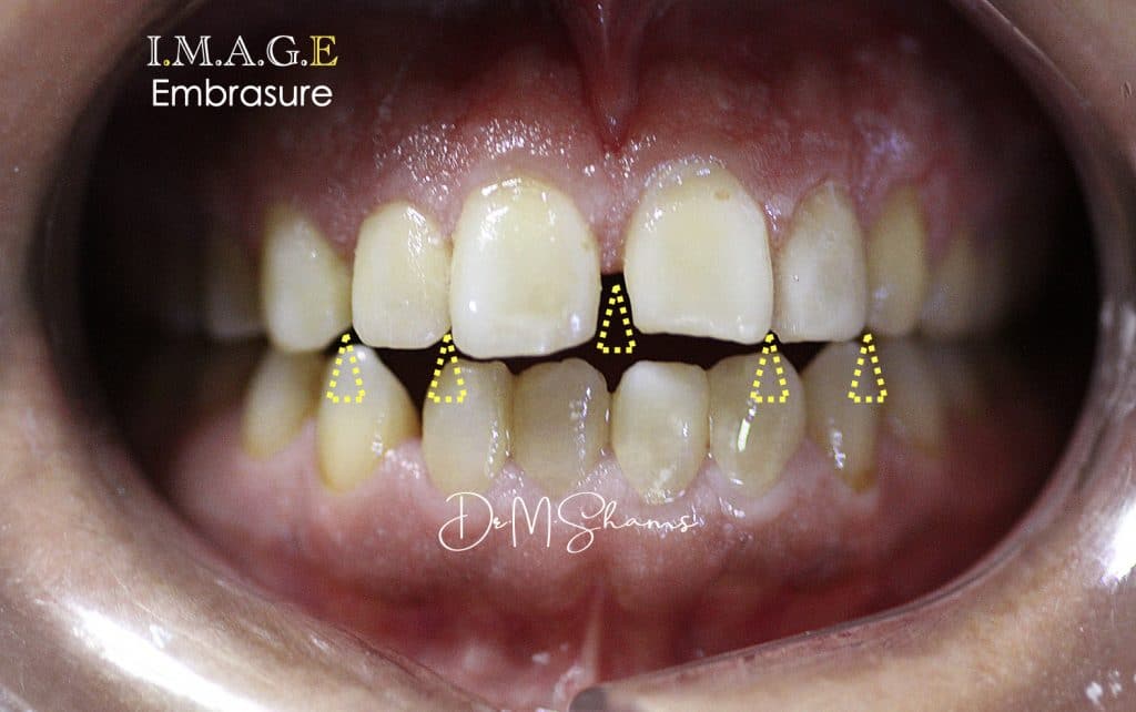 46FEAA64-CFF1-482E-9DCB-AB88A6AC045B