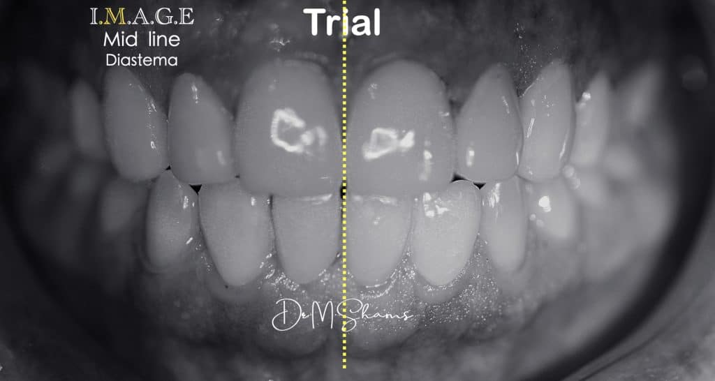 693CDBFF-9D0C-46C3-A77B-A5A992B53CC0