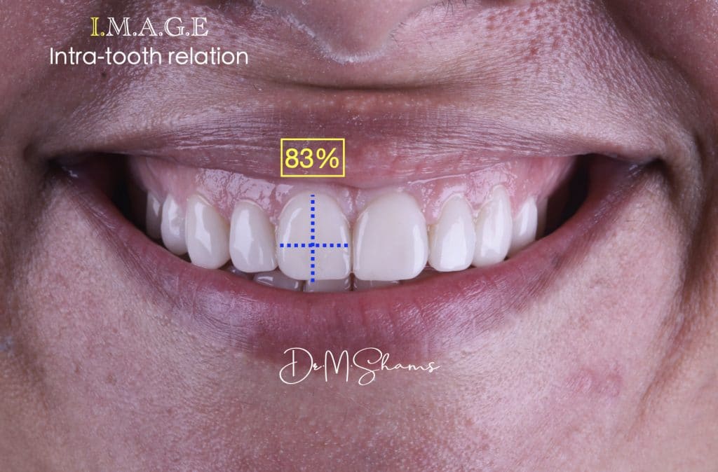 D1664F85-A751-4E8B-B528-B8AD1695484D