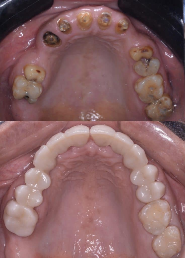 E8CA1332-45F1-4430-9597-0041E914D6C4