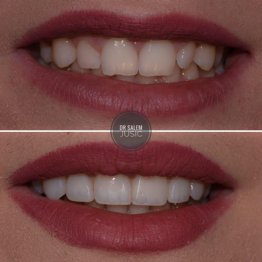 inbound2264141553299249181