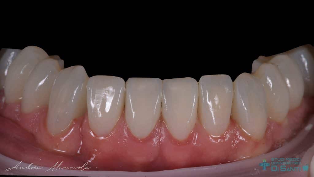 040D90DF-AA22-48BE-B151-0B33B9683D61