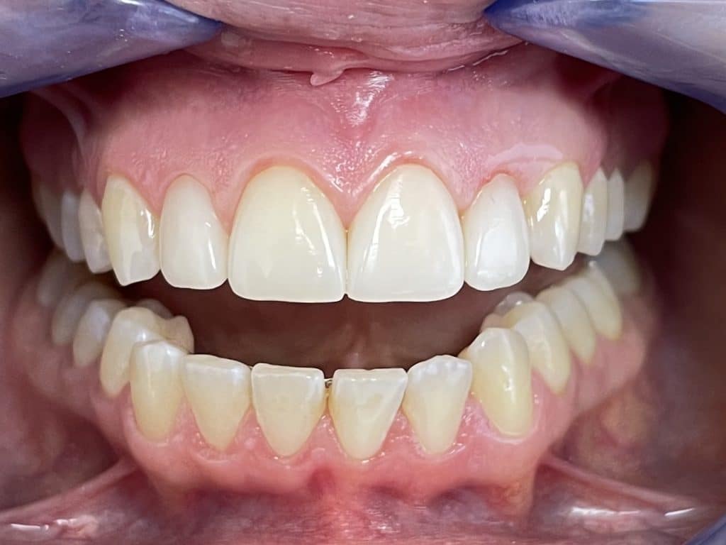 070AE692-A4A4-4D64-86EC-2A5AD7B43415