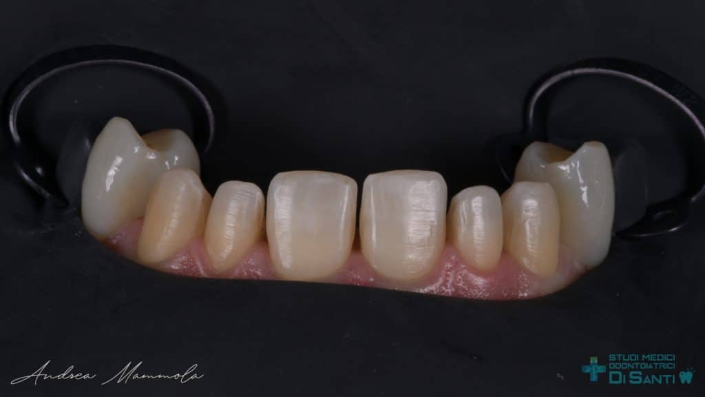 08ED918D-4422-45D2-B7A9-DDB7B9D21E8B