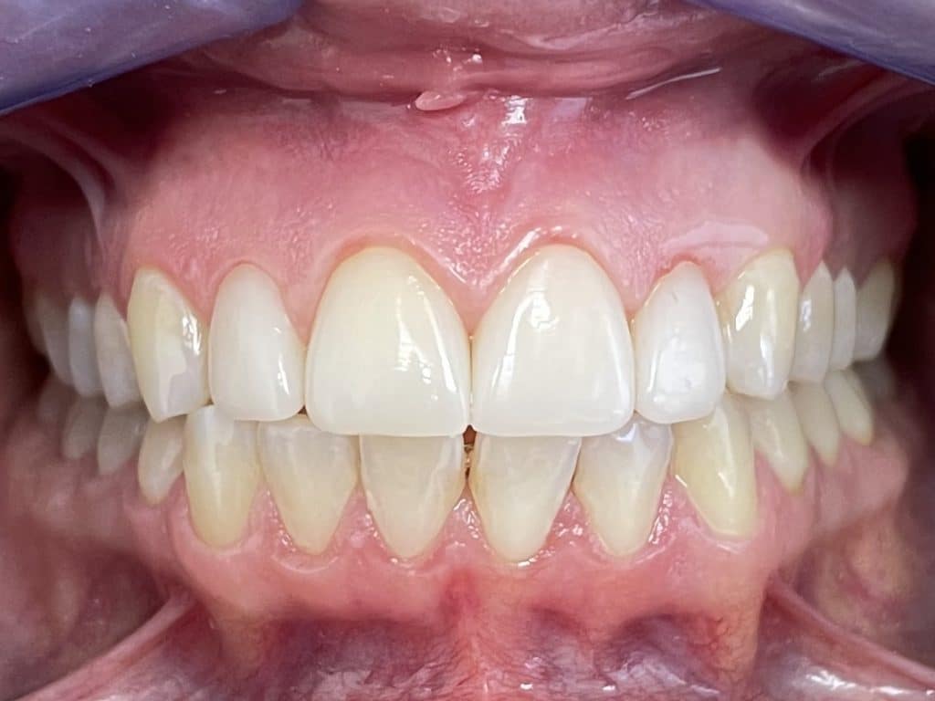 1C3837FB-D369-4D51-8BC5-56B7280B42C2