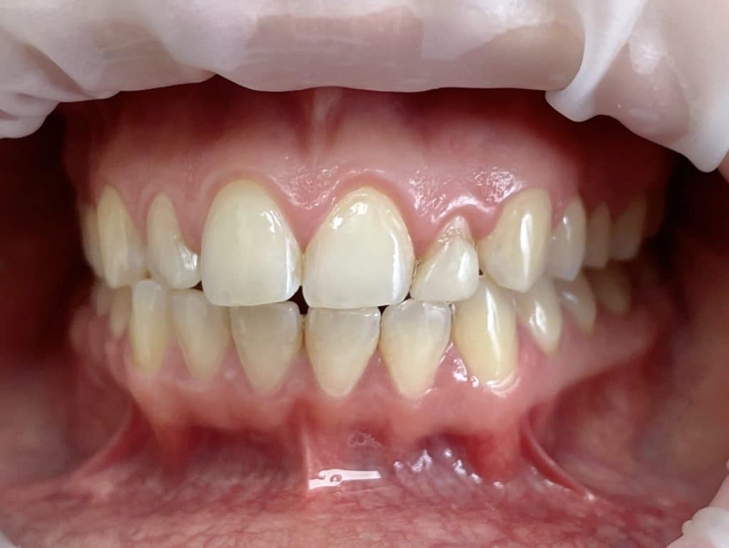 4554E37D-CF3B-459D-9CEB-630D8029D271