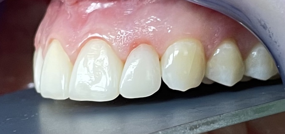 5A0E7D25-B325-494B-A9E5-BC55397C098E