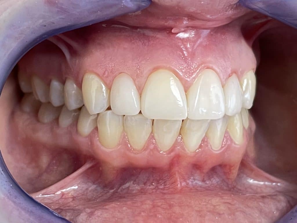 5CD62513-7761-4E6F-8DC5-2254AF1112CE