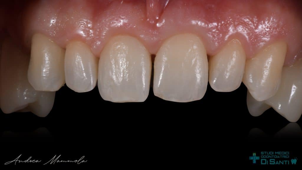 881D2F10-EEA8-4D17-89C8-5A50030586BF