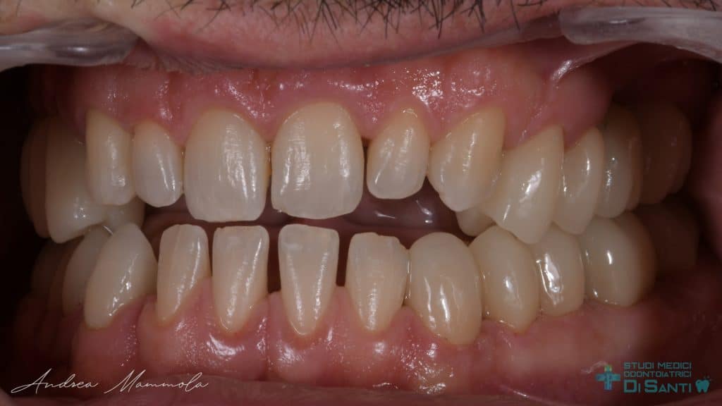 9F1C611D-F04C-418D-A29D-352E27C4440B