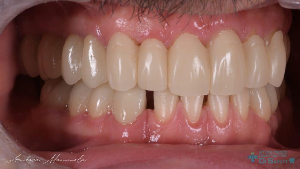 D5B8B323-7120-4166-A910-4A20975C725B